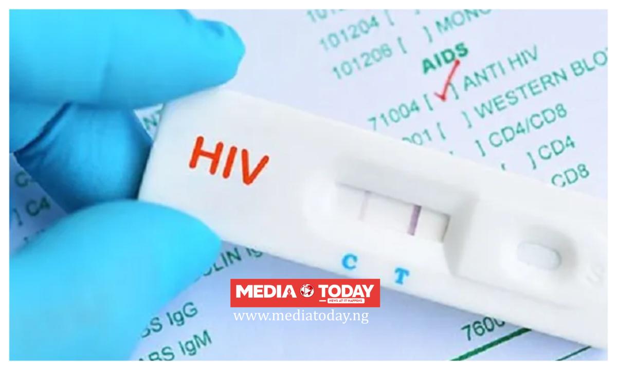 Lagos clarifies reports on 10,430 HIV cases in 2025