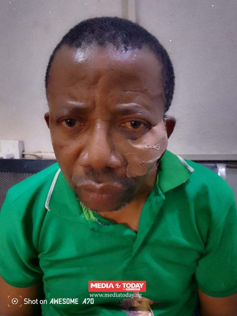 Benin taskforce under fire As brush- party chase injures Dr Akenzua two others,Commissioner vows to fish out fleeing taskforce men, denies extortion, sex-for-favour allegations