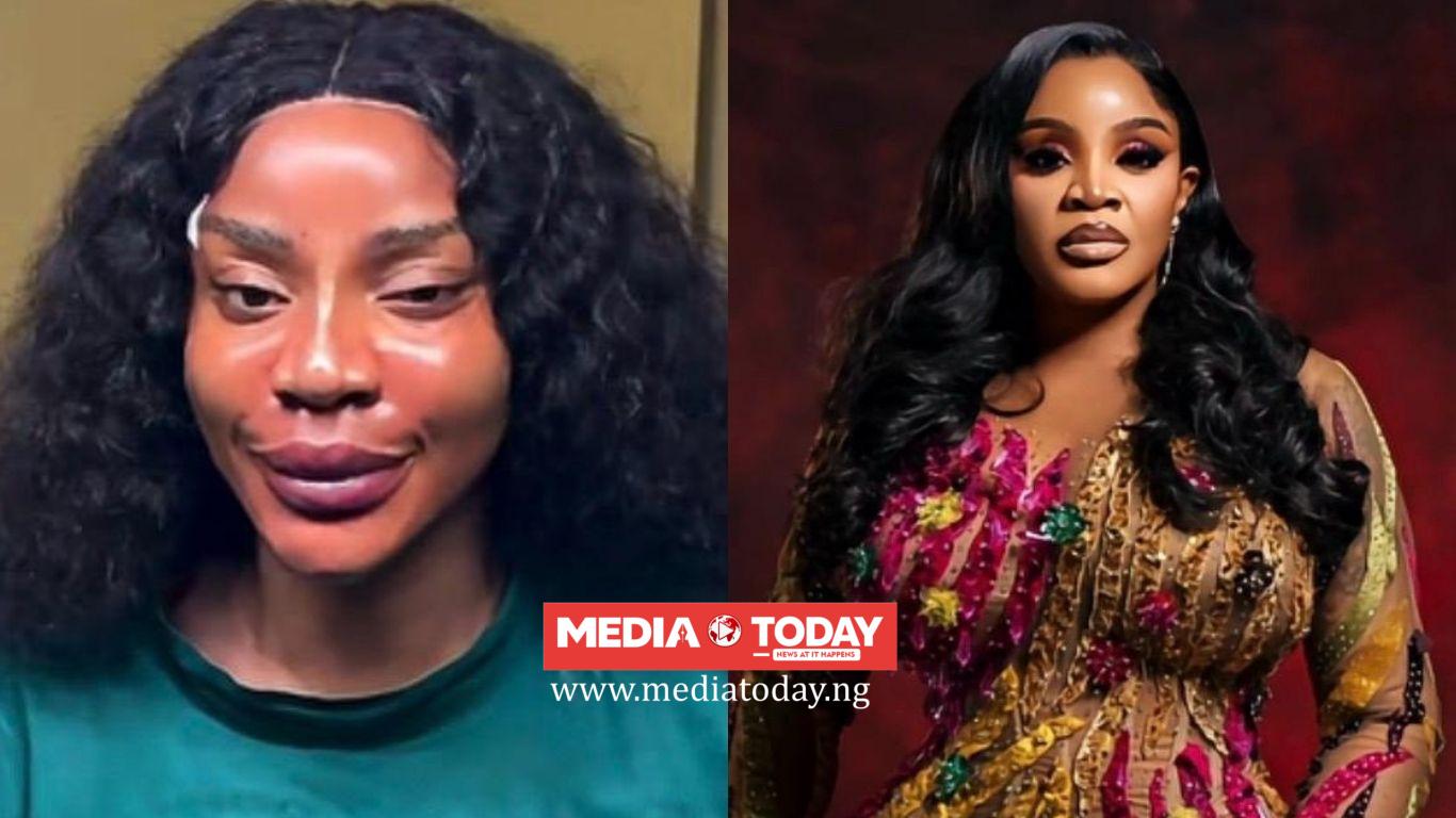 'I got me a new face’ - Uche Ogbodo announces threads, fillers, PDO treatments