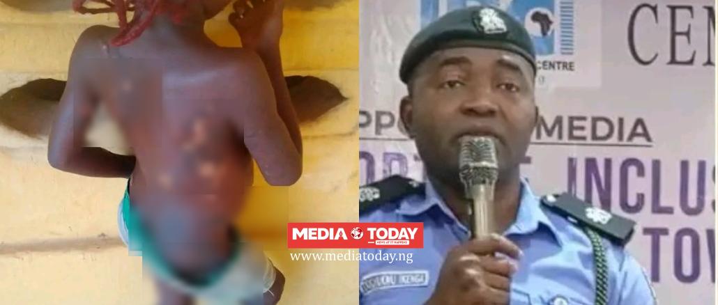 Mother Arrested In Anambra For Allegedly Using Hot Kn!fe On 7-Year-Old Daughter